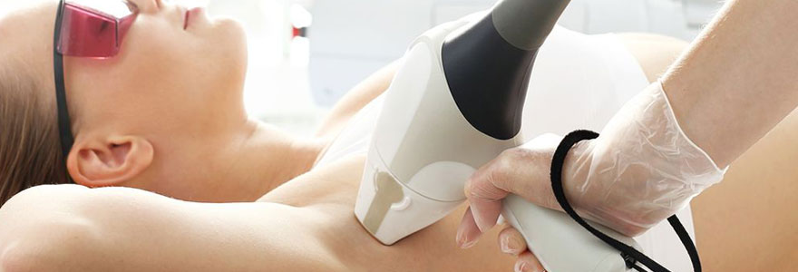 Epilation définitive au laser